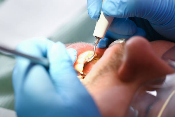 Best Orthodontic Emergency Dentist in Tool, TX